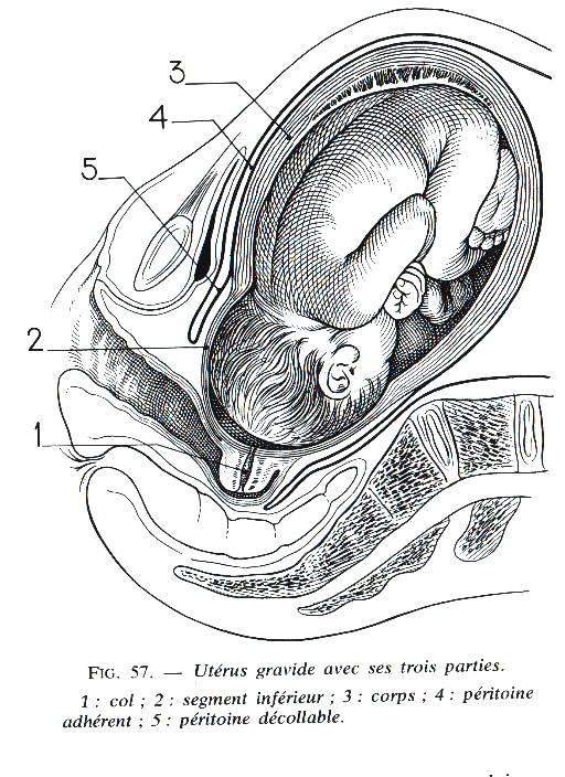 Utérus gravide avec ses trois parties