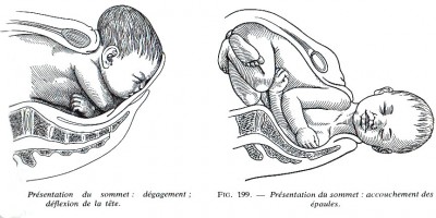 contraintes-naissance-3-400x200 Apocalypse dans Communauté spirituelle